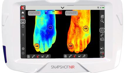 Tragbares Diagnosegerät "Snapshot NIR" soll Ultraschall und Röntgenstrahlen ersetzen