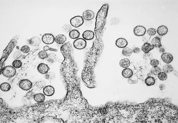 Australisches Labor vermisst gefährliche Viren aufgrund ...