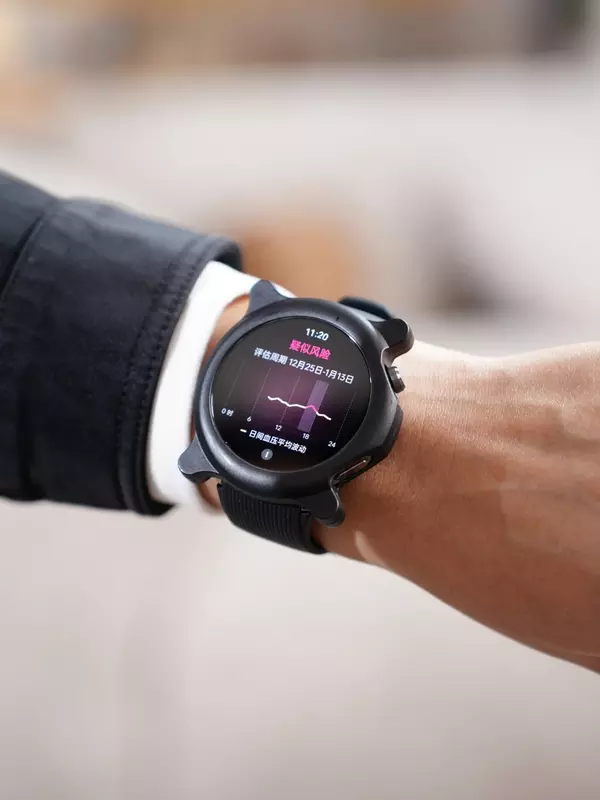 Neue Oppo Watch X2 in einer Schutzhülle