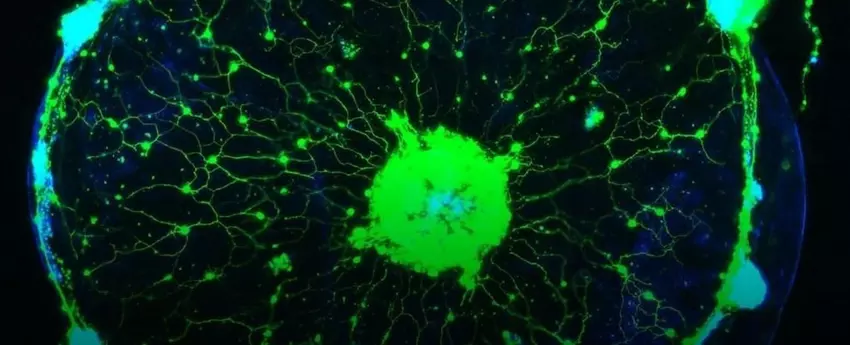 Wissenschaftler haben einen Weg gefunden, die Gedanken von Quallen zu lesen