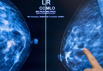 Krebsvorsorge mit künstlicher Intelligenz könnte die ...