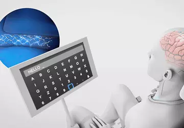 Synchron hat ChatGPT in seine Gehirnimplantate ...