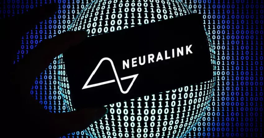 Unregelmäßigkeiten bei Neuralink-Tests in den USA festgestellt 