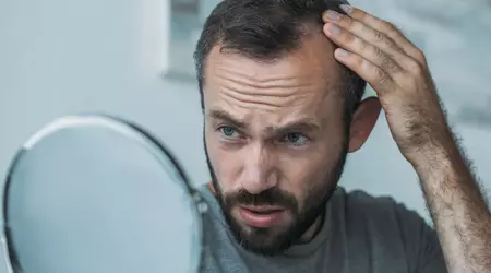 Wissenschaftler haben eine unerwartete Eigenschaft von DNA-Zucker entdeckt, die Haarausfall bei Männern und Frauen beheben könnte