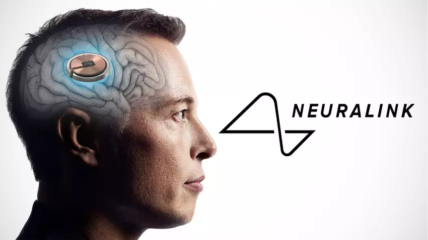 Kein einziger Affe starb - Musk behauptet Sicherheit der Neuralink-Gehirnimplantate