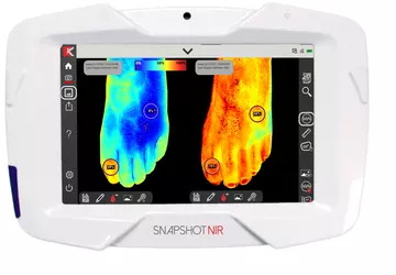 Tragbares Diagnosegerät "Snapshot NIR" soll Ultraschall ...
