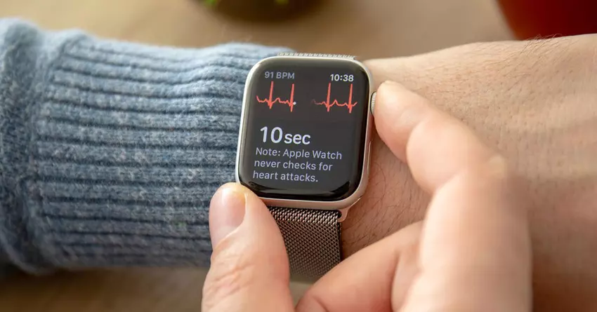 EKG in Kürze für Apple Watch-Benutzer in Mexiko mit watchOS 8. 6