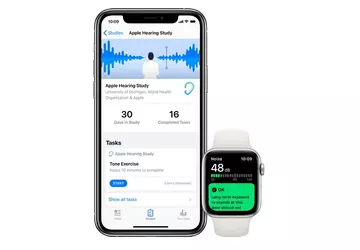 Apple Hearing Studie: 15 % der ...