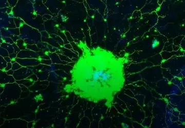 Wissenschaftler haben einen Weg gefunden, die ...