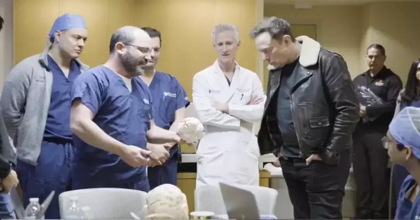 Neuralink erhält Genehmigung für die Implantation eines zweiten Hirnimplantats