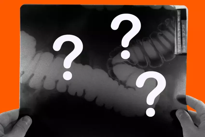 Ärzte, die KI-Geräte verwendet haben, verlieren ihre Qualifikationen