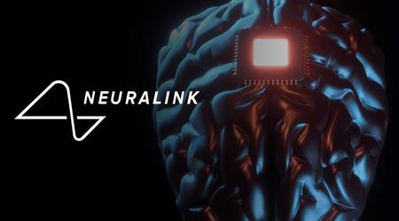 Ausweitung des Neuralink-Programms: Freiwillige aus aller Welt können sich jetzt für die Implantation des innovativen Neurochips bewerben