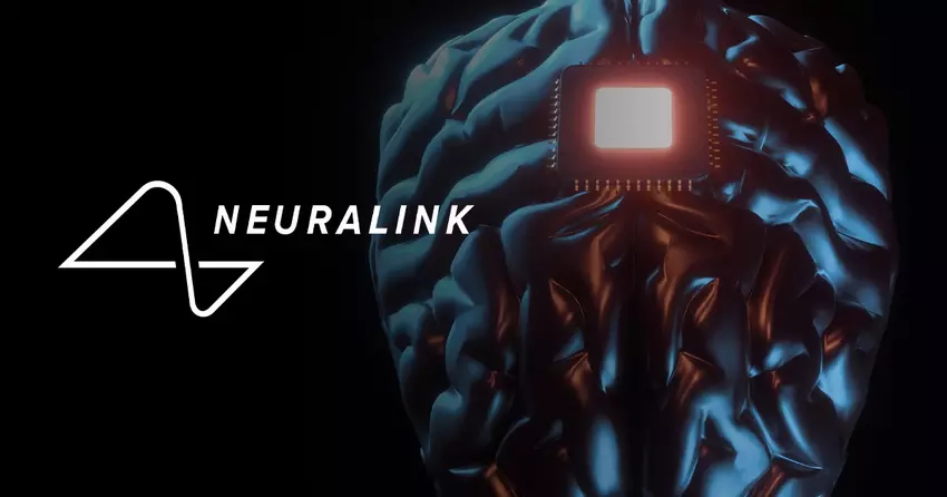 Der nonverbale Mensch ist offen für Kommunikation: Neuralink hat die dritte erfolgreiche Operation zur Implantation eines Chips in das Gehirn eines Patienten durchgeführt