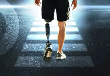 HELLO: 3D-Labor druckt 195 Prothesenelemente für ...