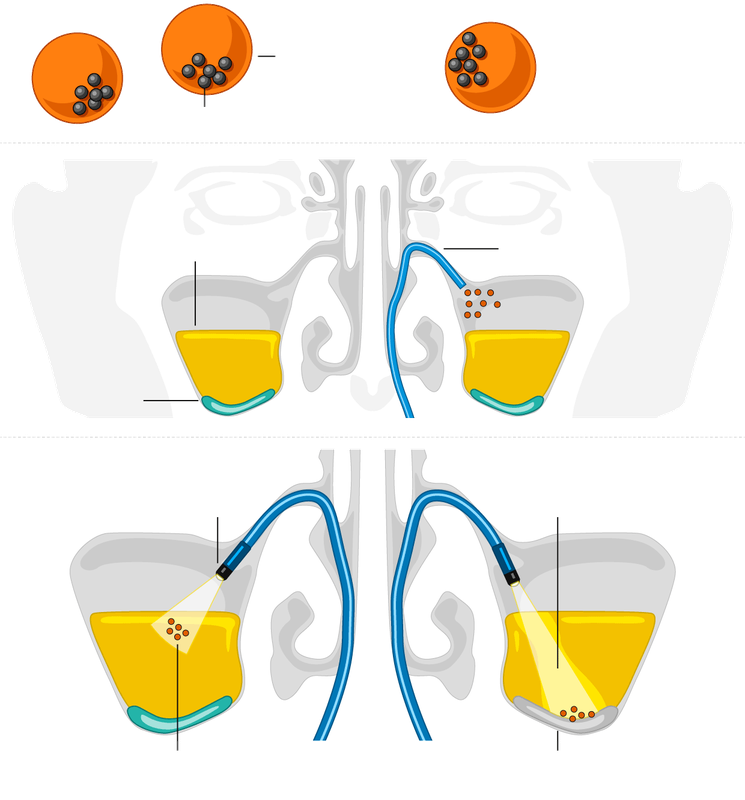 Illustration von Mikrorobotern zur Behandlung von Sinusitis