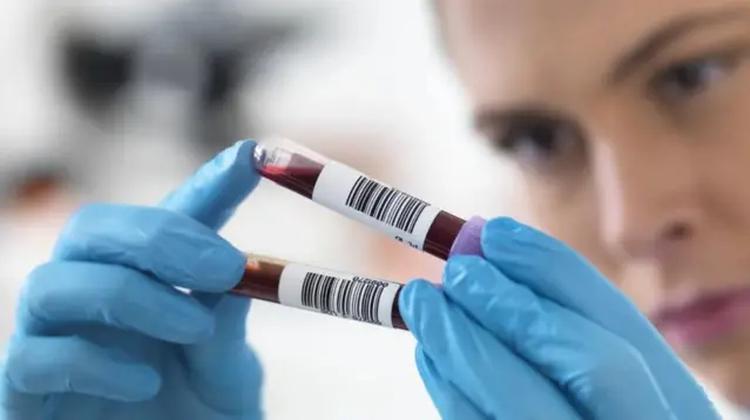 Chinesische Wissenschaftler entwickeln AI-Bluttest, der Krankheiten ...
