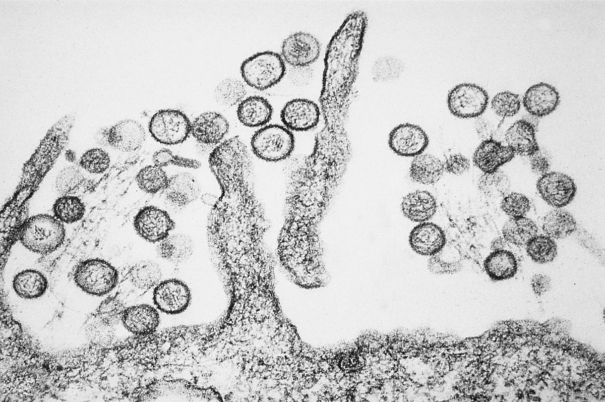 Ein mikroskopischer Blick auf das Hantavirus: neue Bilder Ein Blick ins Innere: eine einzigartige mikroskopische Aufnahme des Hantavirus