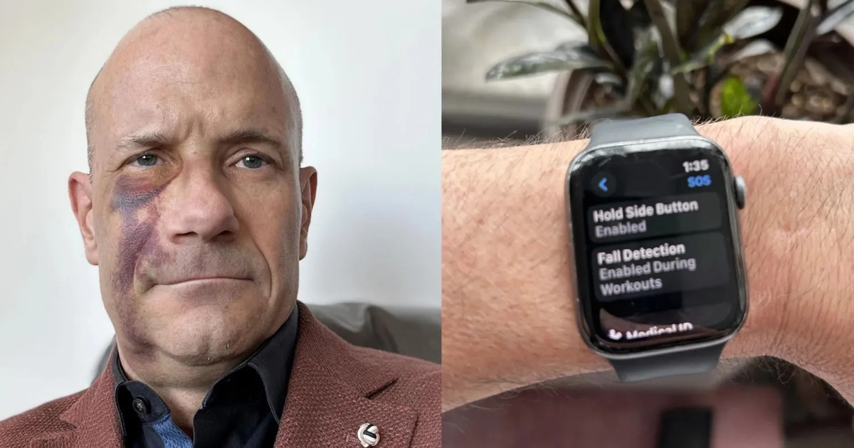 Wie die Apple Watch das Leben eines Radfahrers rettete Wie die Apple Watch das Leben eines Radfahrers rettete