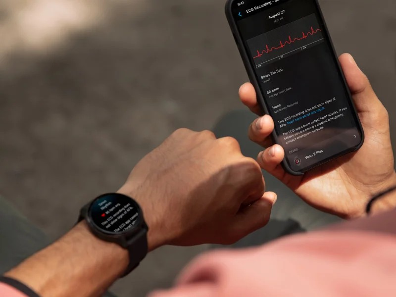Bilder der Garmin EKG-App in Großbritannien und der Schweiz Bilder der Garmin EKG-App in Großbritannien und der Schweiz