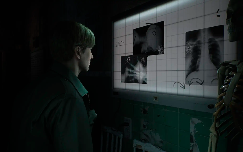 Gruselig und neblig: Konami hat das Remake von Silent Hill 2 angekündigt. Entwickelt von Bloober Team, wird das Spiel für PC und PlayStation 5 erscheinen.-2 Gruselig und neblig: Konami hat das Remake von Silent Hill 2 angekündigt. Entwickelt von Bloober Team, wird das Spiel für PC und PlayStation 5 erscheinen.-2